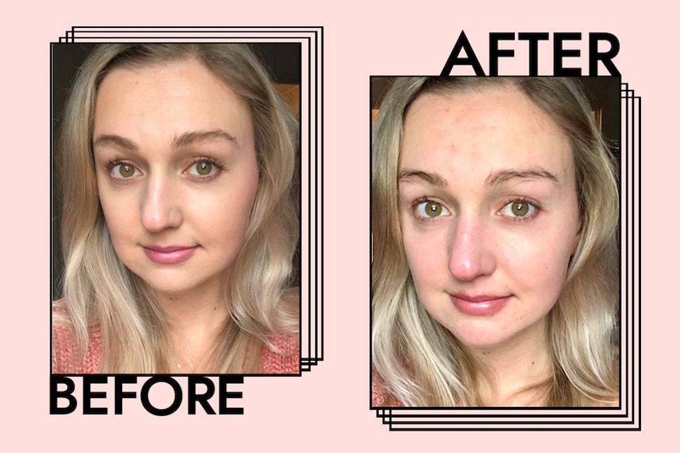 Fotos antes e depois de usar removedor de maquiagem