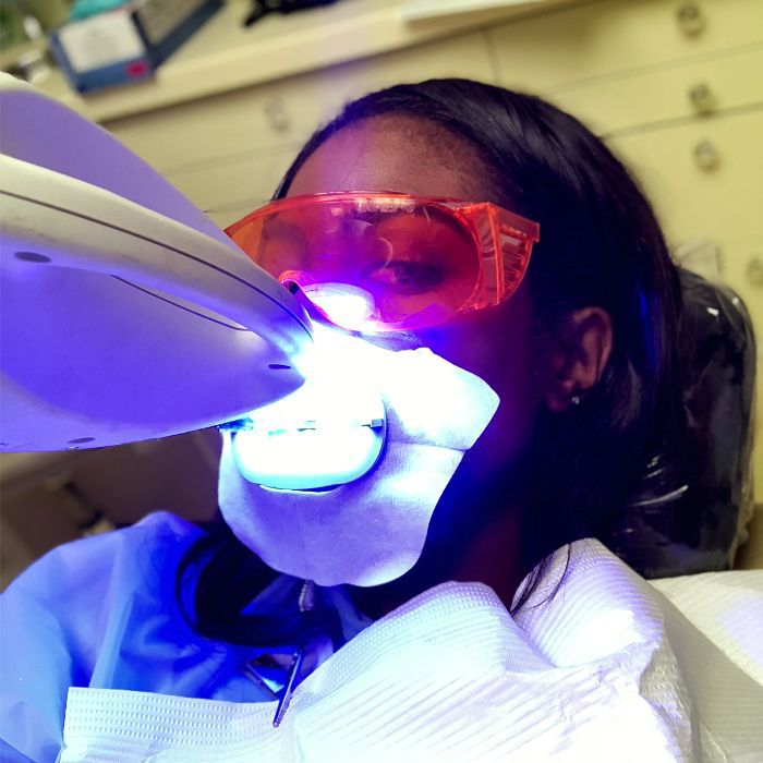 branqueamento de dentes a laser comentários