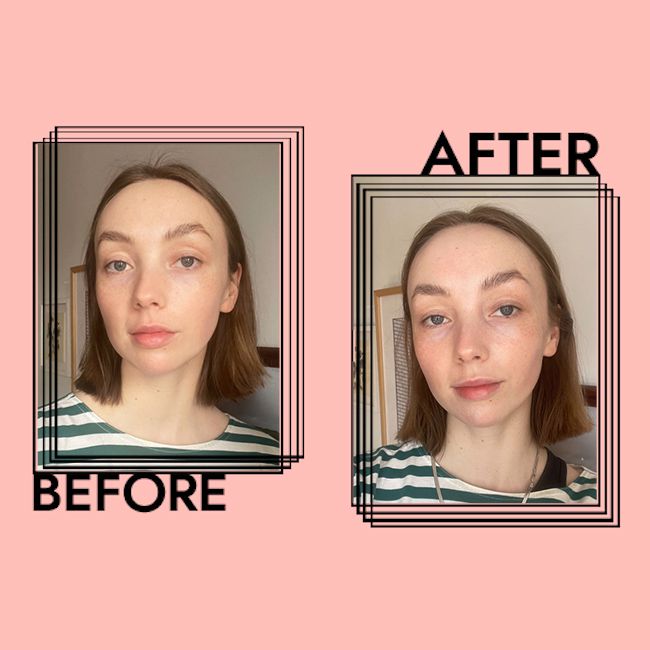 Resultados da massagem facial segundo Erika Weurink